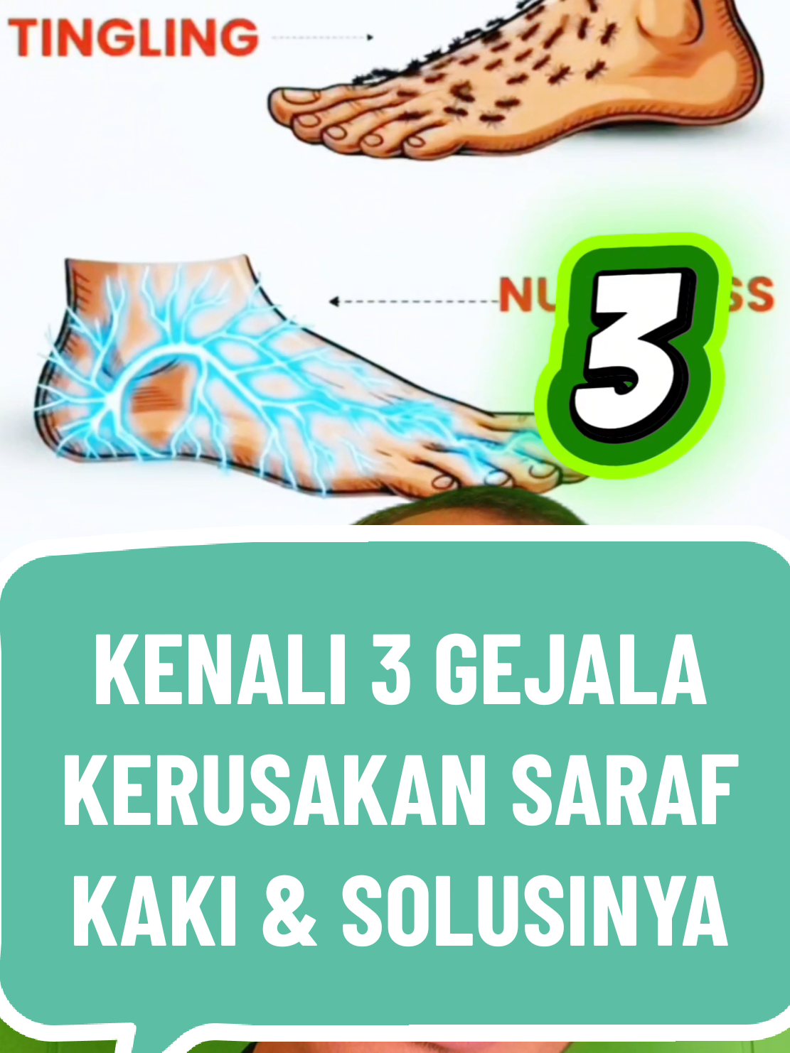 Kenali Gejala Kerusakan saraf tepi di kaki. Neuropati bisa terjadi kapan saja, kenali 3 gejalanya.  #kesemutan #sarafkejepit #doktersarafku 