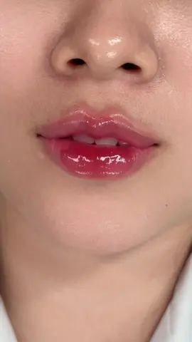 Siêu phẩm môi baby #filler #fillermoi #thuthuybeauty 