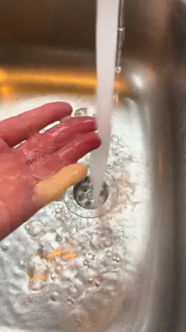 Tell me it’s winter again without telling me it’s winter 🥶 #raynauds #herewegoagain #raynaudsyndrome ❄️