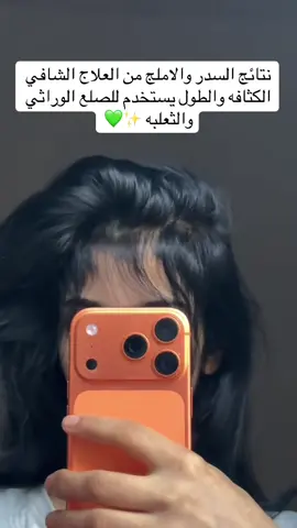 #زيت_السدر_والأملج💚 #الشعب_الصيني_ماله_حل😂😂 #العلاج_الشافي #viraltiktok #بنغازي_ليبيا🇱🇾 