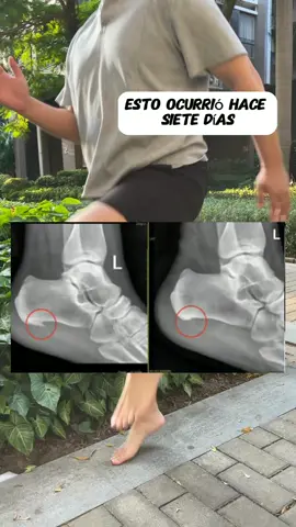 This pink gel has helped me a lot and in the past this pain has been with me all my life.#painrelief #dolores #painrelief #soothing #tiktokmademebuyit 