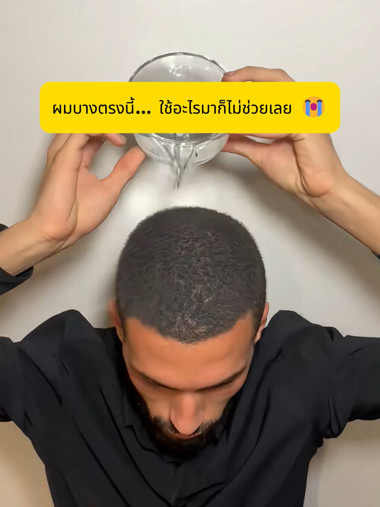 ผมบางไม่ต้องกังวล แตะปุ๊บหนาทันที กันน้ำด้วย! 💧✨”#ผมบาง #หัวล้าน #กันน้ํากันเหงื่อ #ของมันต้องมี #2025trends