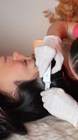 Asmr scalp 💆🏻‍♀️ #asmr #asmrsounds #asmrvideo #relax #relaxing    @yzzyzarate 