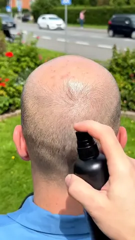 instent hair transformation 😬 #hair #growth #fyp #sora #satifying 