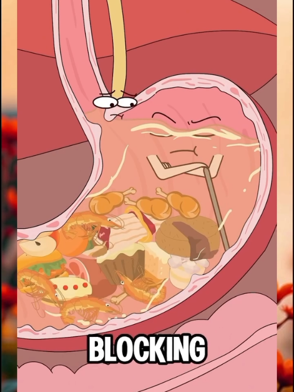 That burning chest pain: it's not your heart, it's heartburn. #heartburn #acidreflux #GERD #physicstime_ #fyp 