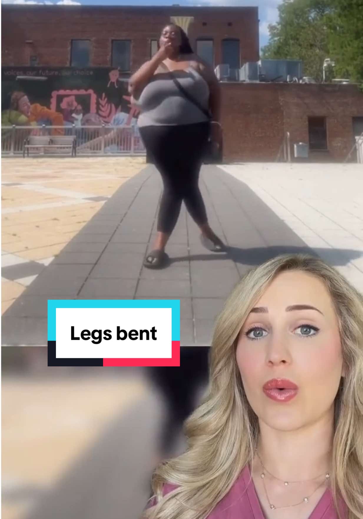 Have you heard of this before?  (VC: @shaydadon94)  #genuvalgum #knockknees #doctorexplains #health #tiktokencyclopediacontest