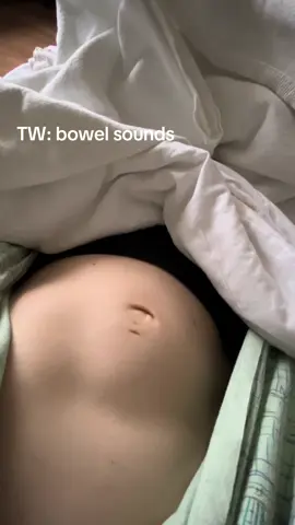 It’s wild both watching and feeling the center of your stomach collapse into itself and create a small crater in your abdomen 🙃 I hate this feeling and wouldn’t wish this pain on my own worst enemy. When this is over, I will be eternally greatful 😩🙏🏻 #Crohns #BowelObstruction #BowelSounds #TummyTrouble #Fyp 