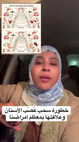 #🦋ROo0🦋 #explorers #ifluencer #سحب_عصب_الاسنان 