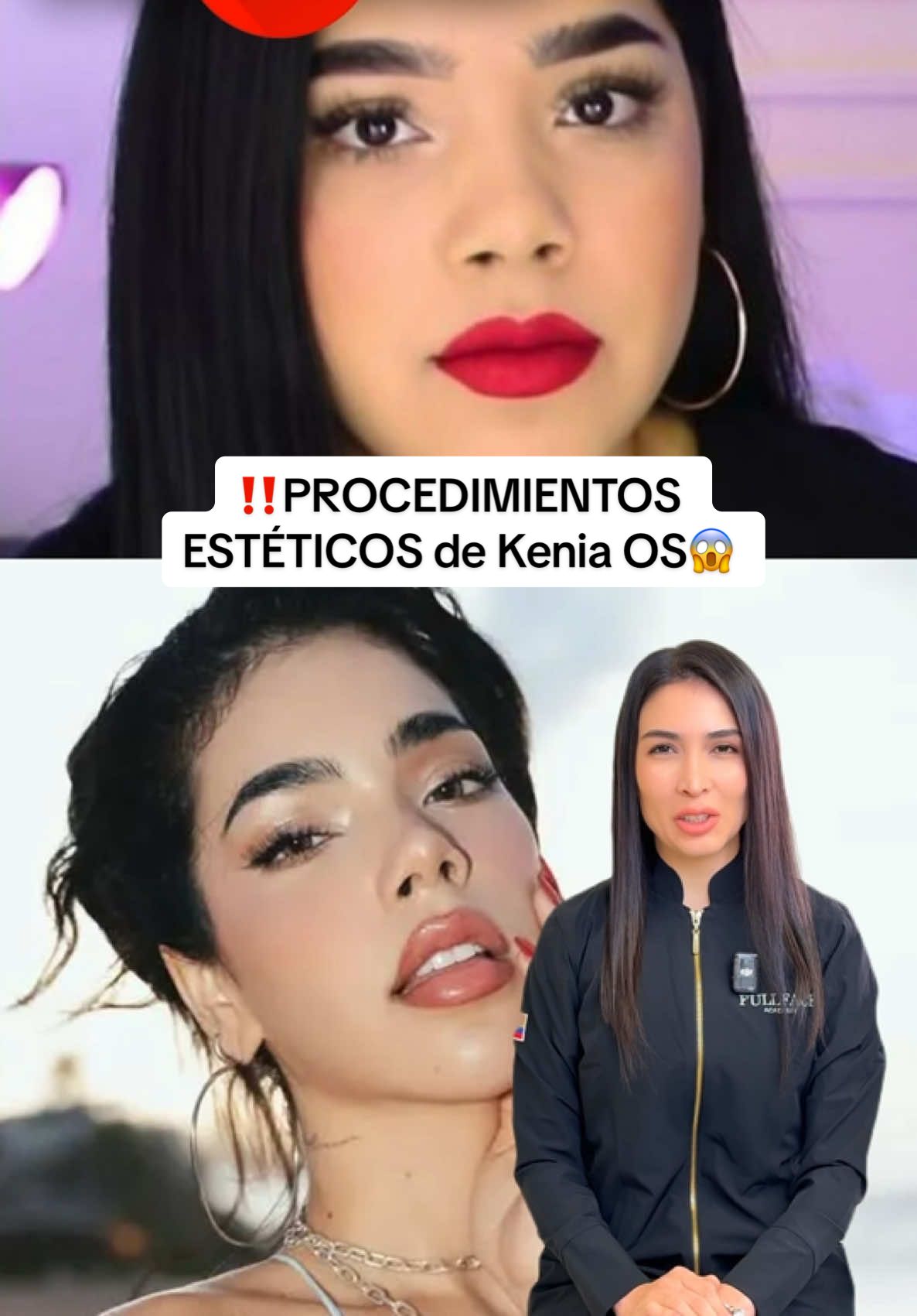 El cambio de Kenia OS es un gran ejemplo de armonización facial. Respetó su esencia y potenció lo mejor de sus rasgos. Una transformación sutil, estratégica y bien ejecutada. ¿Te gustaría una armonización así? Mándame un mensaje 🙌🏽 #acidohialuronico #botox #medicinaestetica #labios #keniaos 