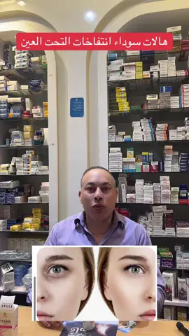 ايساك اي  كونتور كريم #مطاعم #ايام_زمان_البساطة_والعفوية #مداهم 