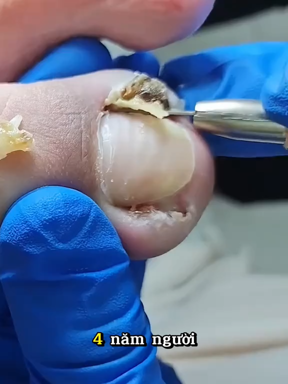 Móng tay đẹp hơn từng ngày nhờ khoé móng gọn gàng. #chamsocmong #gomongtay #mongdep #khoemong