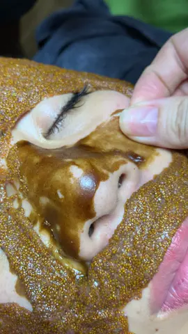 Rảnh#chamsocdamun#chamsocdaseo#chamsocdanam#tanbinh#Lqspa&academy