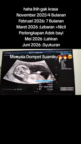 Semoga sehat sampai waktunya ,amin Menyala suamiku🔥❤️🥰😍 #fyp #bumilsehatbayisehat🤰♥️😘😘 