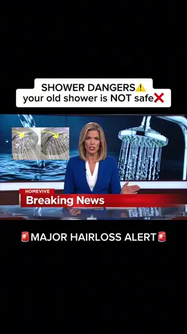 #hairloss #women #beauty #usa 