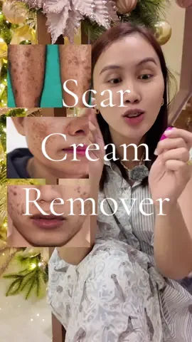 Etobg brand super bilis ng effect #scar #scarcream #scarremover 