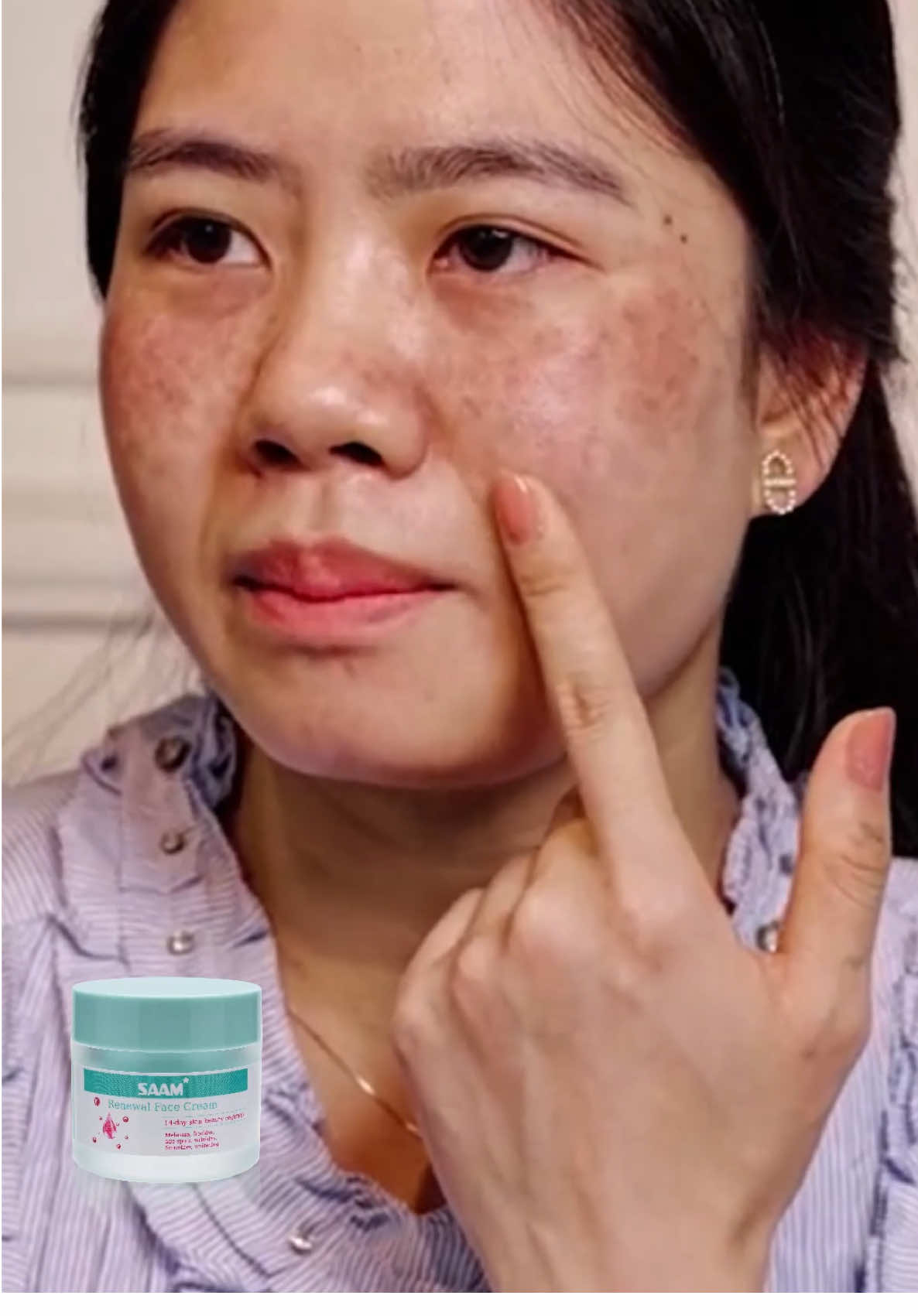 De_Mit nur einem Produkt habe ich meine reine Haut zurückbekommen.