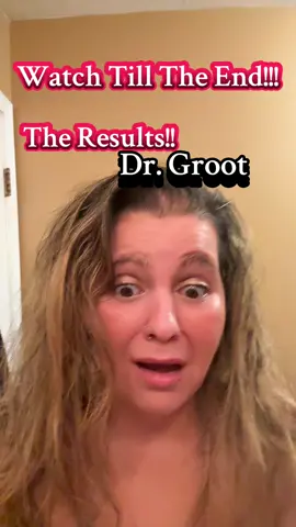 There is so many good ingredients that if you don’t look you just wouldn’t know!! No wonder why when you use this your hair gets healthier and thicker and all that goodness!! Grab it before it’s gone!!!@Dr. Groot Hair #hairgrowth #tiktokshopblackfriday #hairtok #tiktokshopcybermonday #hair