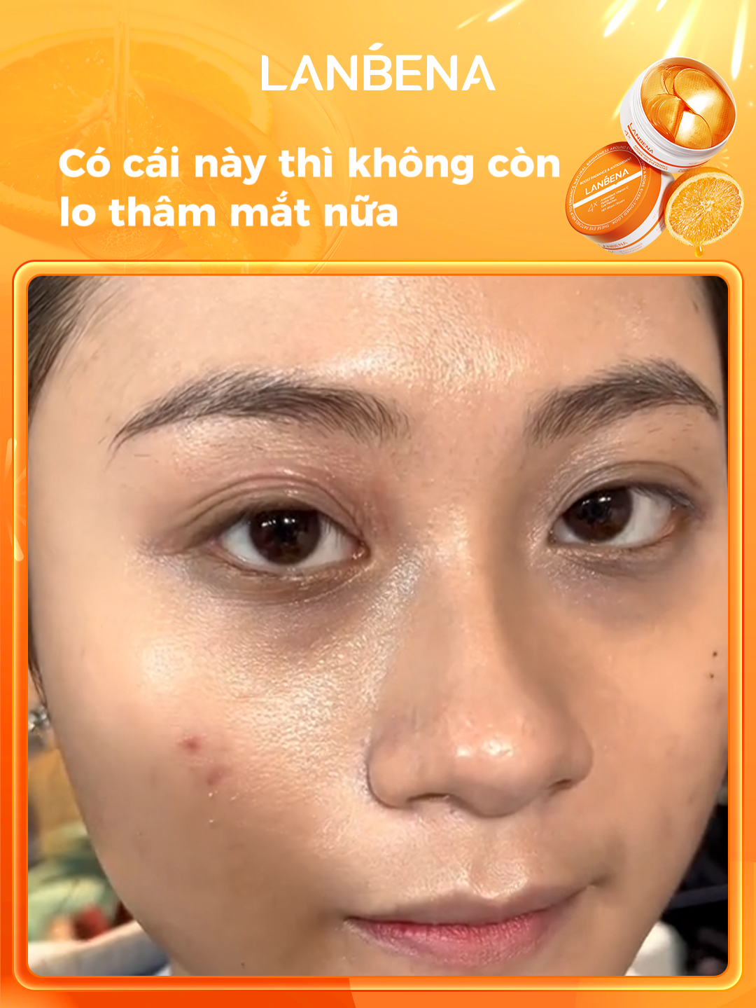 Sợ quầng thâm thì xài mặt nạ mắt vitamin C đều đặn đi! #lanbena #quangtham #tritham #skincareroutine #skincare #matnamat #matnamatgiamthamquanmat #viral4