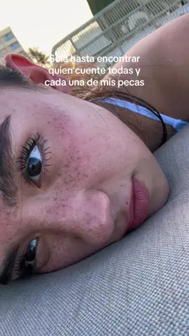Sun-kissed para siempre 🌅 #fyp #pecas #freckles 