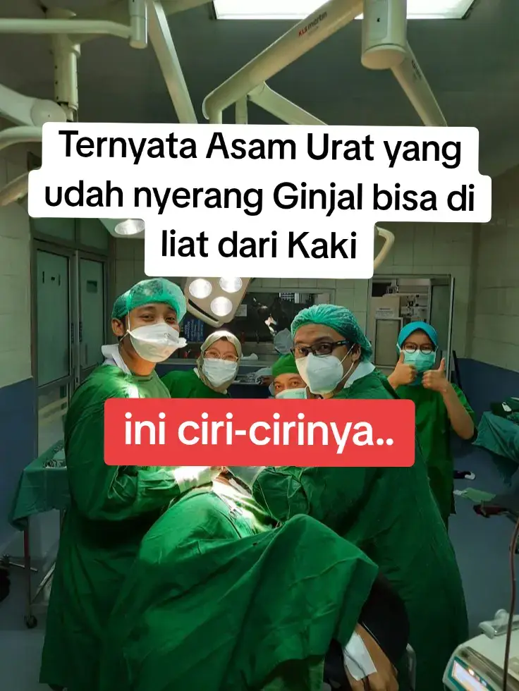 Banyak orang nggak sadar kalau tubuh itu selalu ngasih “kode keras” sebelum ginjal benar-benar kena. Dan salah satu tanda paling mudah dilihat… ada di kaki kamu sendiri! Kalau asam urat mulai mengganggu fungsi ginjal, beberapa perubahan di kaki biasanya muncul tanpa kamu sadari: 1. Kaki sering bengkak terutama pagi & malam Ini tanda ginjal mulai susah membuang cairan dan toksin dari tubuh. 2. Kulit kaki terlihat mengkilap & terasa kencang Biasanya muncul karena penumpukan cairan berlebih—pertanda filtrasi ginjal melemah. 3. Ujung jari kaki terasa dingin & mudah kesemutan Aliran darah terganggu karena kadar asam urat yang tinggi. 4. Nyeri di pergelangan kaki yang datang tiba-tiba Ini bisa terjadi kalau kristal asam urat sudah menumpuk dan ginjal nggak bekerja optimal. 5. Kaki cepat capek meski aktivitas ringan Salah satu sinyal tubuh kalau fungsi ginjal mulai menurun karena beban asam urat. Kalau kamu mulai merasakan 1–2 gejala ini, jangan tunggu makin parah. Semakin cepat kamu atur ulang asupan dan pola hidup, semakin besar peluang ginjal kembali kuat dan kadar asam urat turun. Mau aku kirim panduan lengkap cara nurunin asam urat biar ginjal tetap aman? Komen “MAU” di bawah 👇 Atau langsung WA aku di sini ➜ 0877-5058-4646