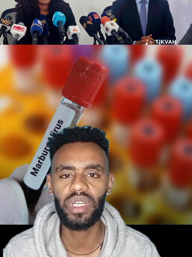 ህዳር 8/2018 #ሰበር_ዜና #ጂንካ  #ደቡብኢትዮጵያ #ጤና #hemorrhagic 