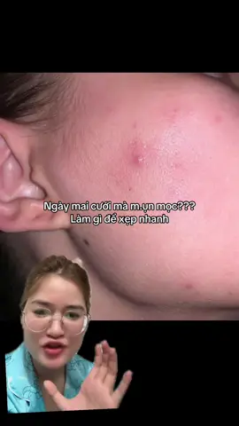 Kem dưỡng La Roche Posay giảm m.ụn nhanh 8h Dou+M #LRPVN, #larocheposayvn + Franchise (#effaclar) #chamsocda #larocheposay 