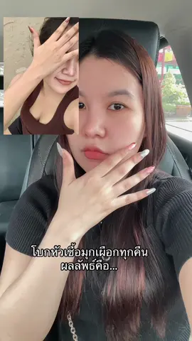 หน้าดรอปไปเลย เมื่อเทียบกะผิวตัว😂 #หัวเชื้อมุกเผือกเคียร่า #หัวเชื้อผิวขาว #ขึ้นฟีด 