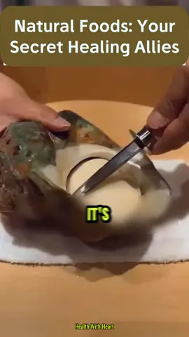 Natural Foods: Your Secret Healing Allies 👉🏻Discover your body’s potential — link in bio.