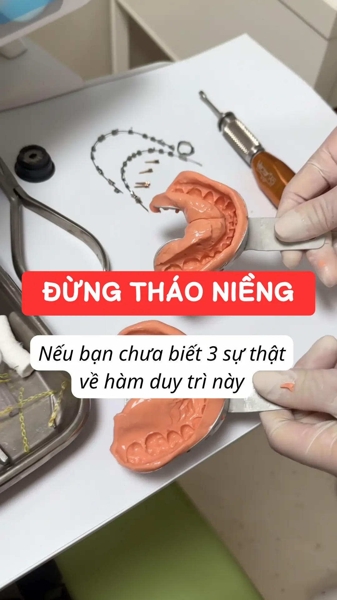 Niềng 2 năm cùng 30tr. Chỉ cần sai 1 trong 3 lỗi với hàm duy trì là răng có thể chạy lại y như chưa từng niềng #hamduytri #niengrang #retainer #vietdentallab #hamduytritrongsuot 