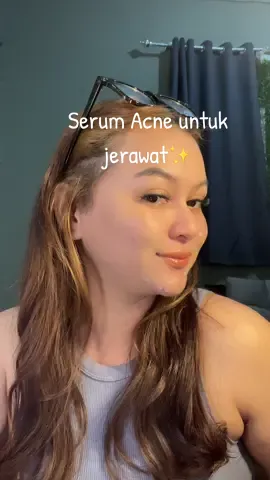 Jerawat Hormon ga kelar kelar!! Icelerskin jadi solusi buat jerawat kamu #icelerskin #icelerskinacnespottreatment #icelerskinprecisionacnespotserum 