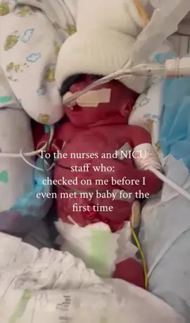 @heynicumamas  - To our NICU teams who held our babies when we couldn’t… thank you. 💜 For being the steady hands in a world we never expected to enter. For the way you quietly loved our tiny fighters in the hours we weren’t able to be there. For every soft whisper, every gentle reposition, every “they did so good today” that held our exhausted hearts together. Prematurity is something no parent prepares for. The NICU becomes a place where time moves differently… where fear and hope sit side by side… where we learn a new kind of strength we never asked for. And in the middle of that overwhelming, sacred space — there are nurses and a NICU team who become our lifelines. Who see our babies not as diagnoses, but as miracles. Who celebrate every breath, every gram, every step forward. Who care for them with a tenderness that stays with us long after we leave those hospital doors. This Prematurity Awareness Month, we honor them — The ones who loved our babies when our arms were empty. The ones who cared for them in the fragile hours of the night. The ones who gave us hope when we felt lost. To every NICU nurse and team member : thank you for loving our tiny miracles like they mattered. Because they do. More than words can ever say. 💜 #PrematurityAwarenessMonth #NICU #NICUMom #NICUBaby 