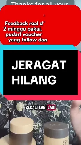 Replying to @ctsaari5679 Kak Lin dah cuba, jeragat makin pudar dalam 2 minggu! Jangan lepaskan peluang dapat diskaun kalau buat pembelian lebih. Jom cuba sekarang! #bartechbeautee #whiteningcream #whiteninggel #skincarejourney #jeragat 