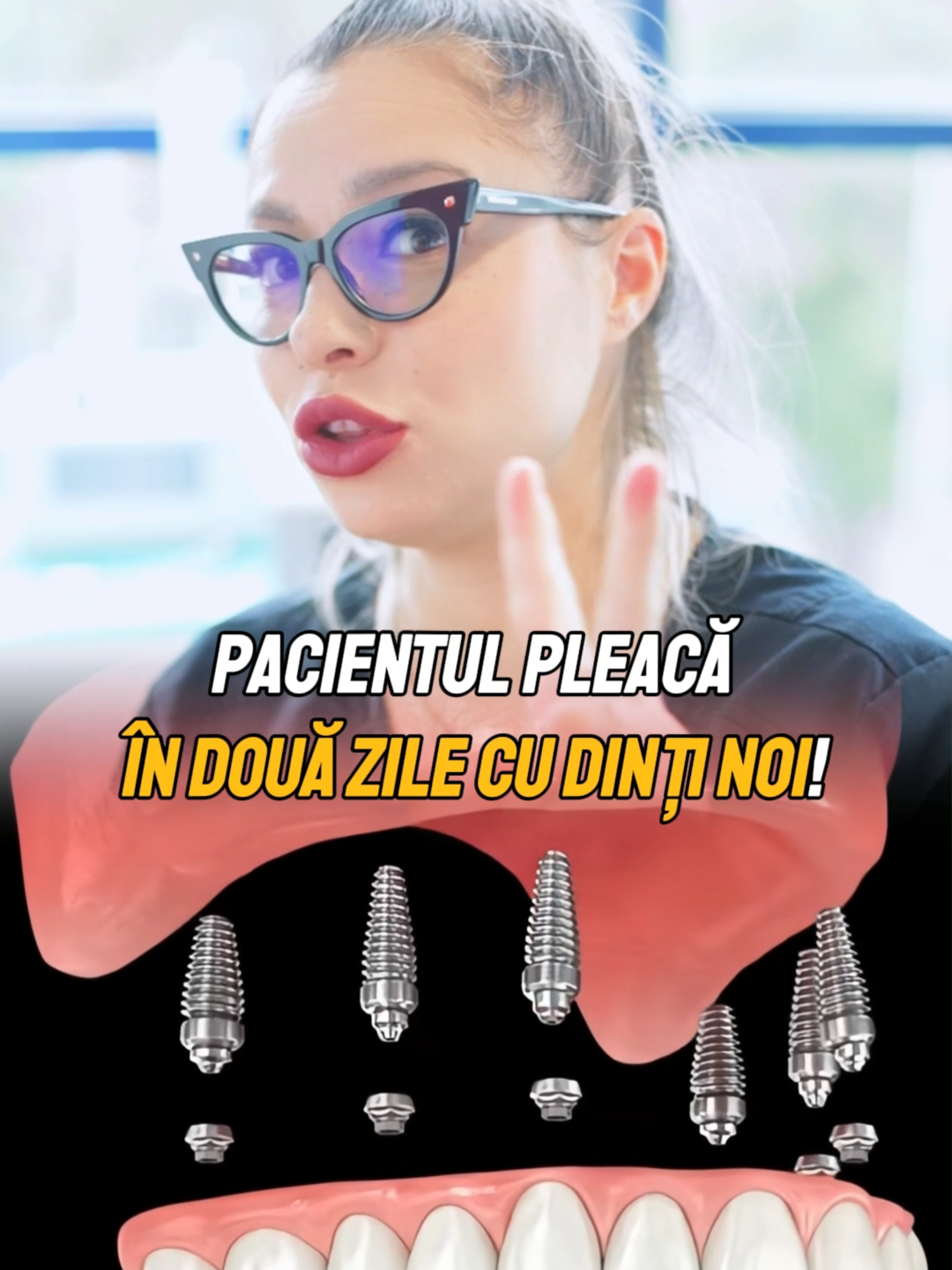 Asa functioneaza dantura fixa @clinicile.dralecu#doctor #cliniciledralecu #implantdentar #stomatologie #allon #allon4