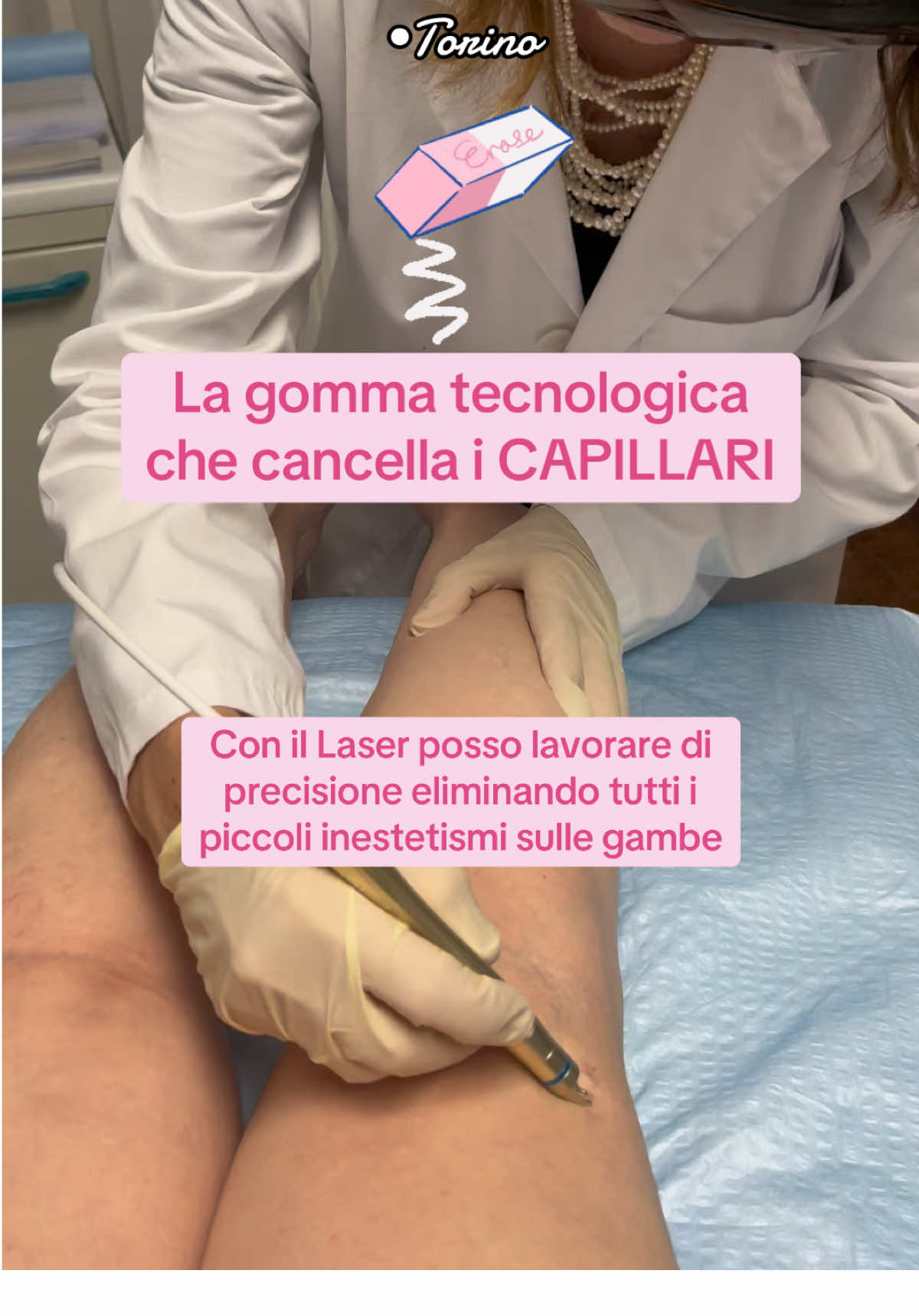 Troppo spesso le mie pazienti mi hanno confessato di aver rinunciato a mettere gonne o vestiti, e persino ad andare al mare 🥹 perché i capillari sulle gambe erano diventati un pensiero fisso.  👩🏻‍⚕️👇 Ecco perché al trattamento TRAP, la fleboterapia rigenerativa per la cura dei grandi vasi, che pratico nel mio Studio già da molti anni, ho aggiunto il nuovissimo e potente laser vascolare per il trattamento dei piccoli capillari, sia rossi che blu. 👇 Con il trattamento giusto, puoi tornare a sentirti libera e sicura e ricominciare ad amare le tue gambe, già dalla prossima primavera! Richiedi informazioni e prenota una visita di consulenza… questo è il momento perfetto per incominciare Dottoressa Lorena Fortuna 📍Torino Via Madama Cristina 78 ☎️ 011.66.88.100 📱339 465 6253 Segui le mie pagine, ti parlo di benessere, salute, bellezza, consigli di cura della pelle e di skincare e le migliori tecnologie per il viso ed il corpo  #medicinaesteticatorino #lasercapillaritorino #teleangectasie #traptorino #gambeperfette     