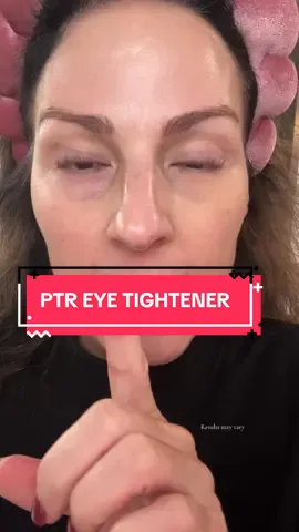 Replying to @Priscilla Johnson Undereye bags & dark circles don’t stand a chance against @Peter Thomas Roth Labs Easy Wear Temporary Eye Tightener✨ #titkokshopblackfriday #tiktokshopcreatorpicks #openyoursuperstory #eyebags #superbranddaybfcm