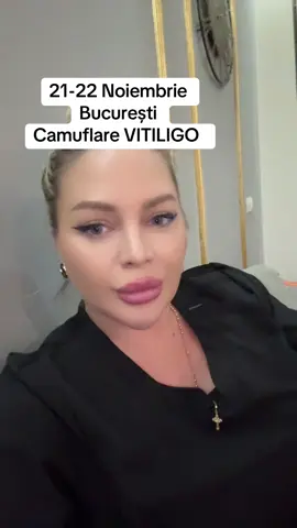 21-22 Noiembrie București  Pentru programări 0723 291 345  Camuflare Vitiligo Skin Story  #bucuresti #camuflare #vitiligo 