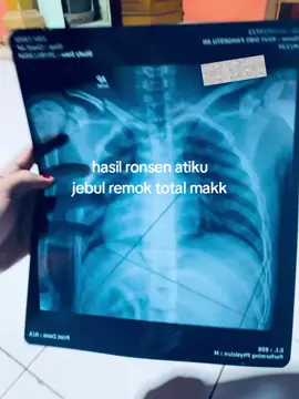 tulange ra senterr😩 #fyppage #rongsen #sadstory #sad 