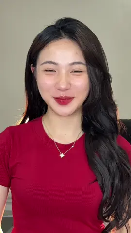 Biến hình cho e khách 2k7 #filler #botox 