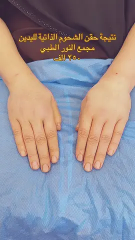 #حقن اليدين