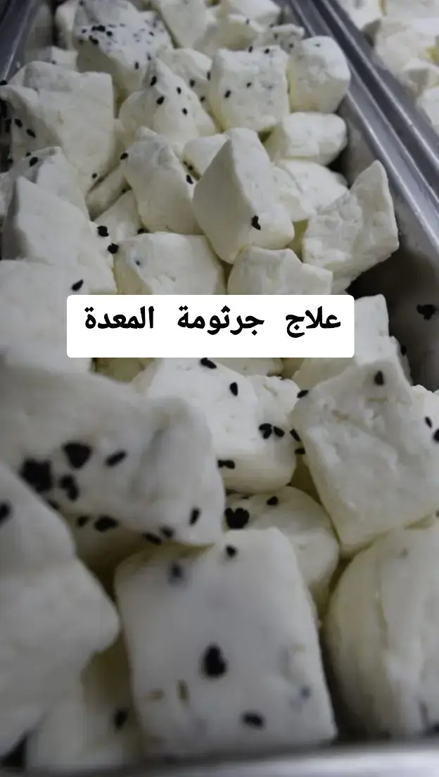 #اكسبلور #foryou #صحة #for #fyp 