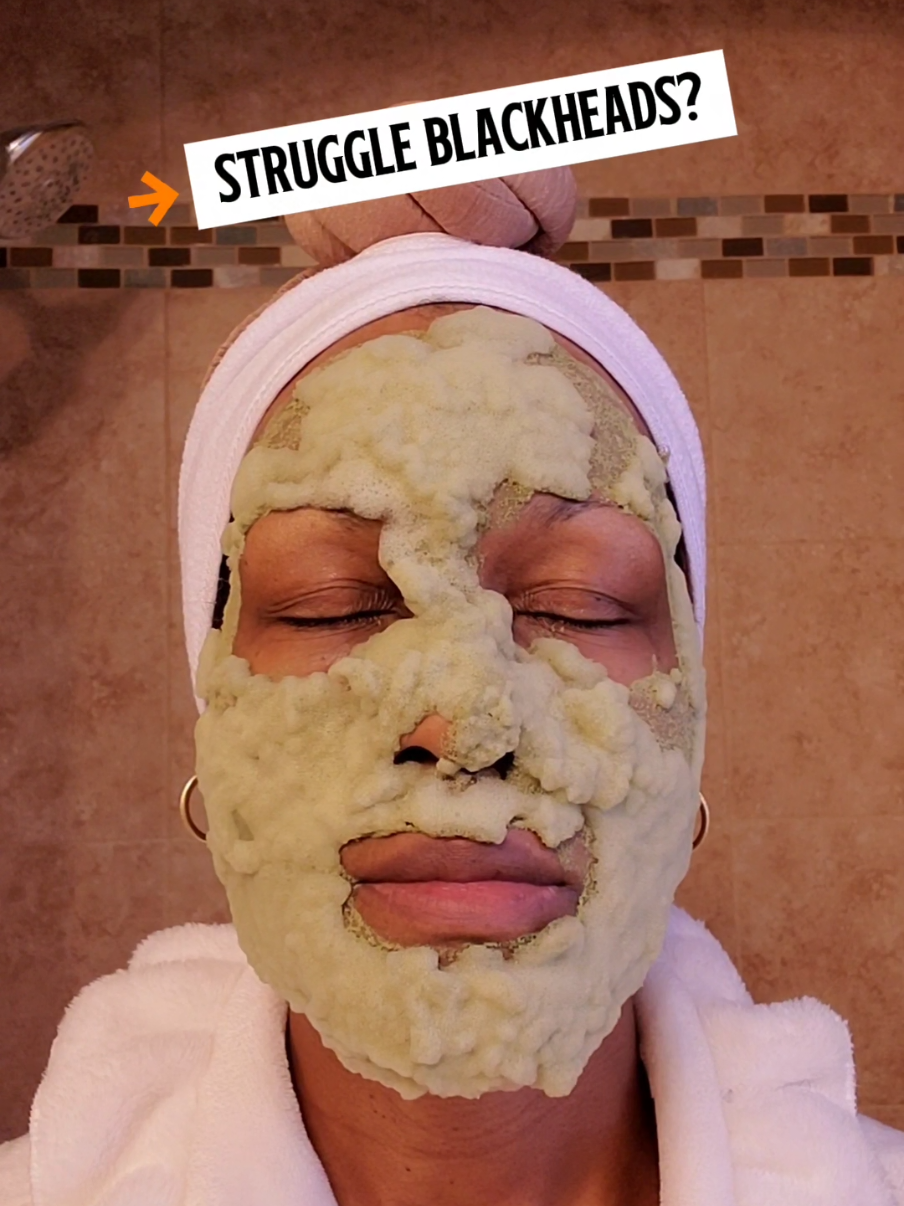 If you struggle with blackheads then you should try this bubble mask. @P.CALM  #tiktokshopblackfriday #tiktokshopcybermonday #tiktokshopcreatorpicks #bubblemask #skincare 