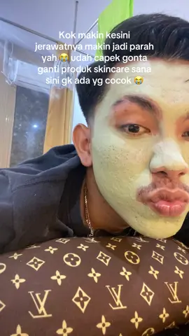 Gak tau harus mau di apain lagi dan makai produk apalagi 😭😭 #acnefighter #acnetreatment #davienaskincare @dr okypratama #skincare #skincareviral 