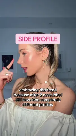 i’m not doing it again i like my nose HOW IT IS #nosejob #perfectnose #sideprofile #sideprofilechallenge #sideprofilecheck 