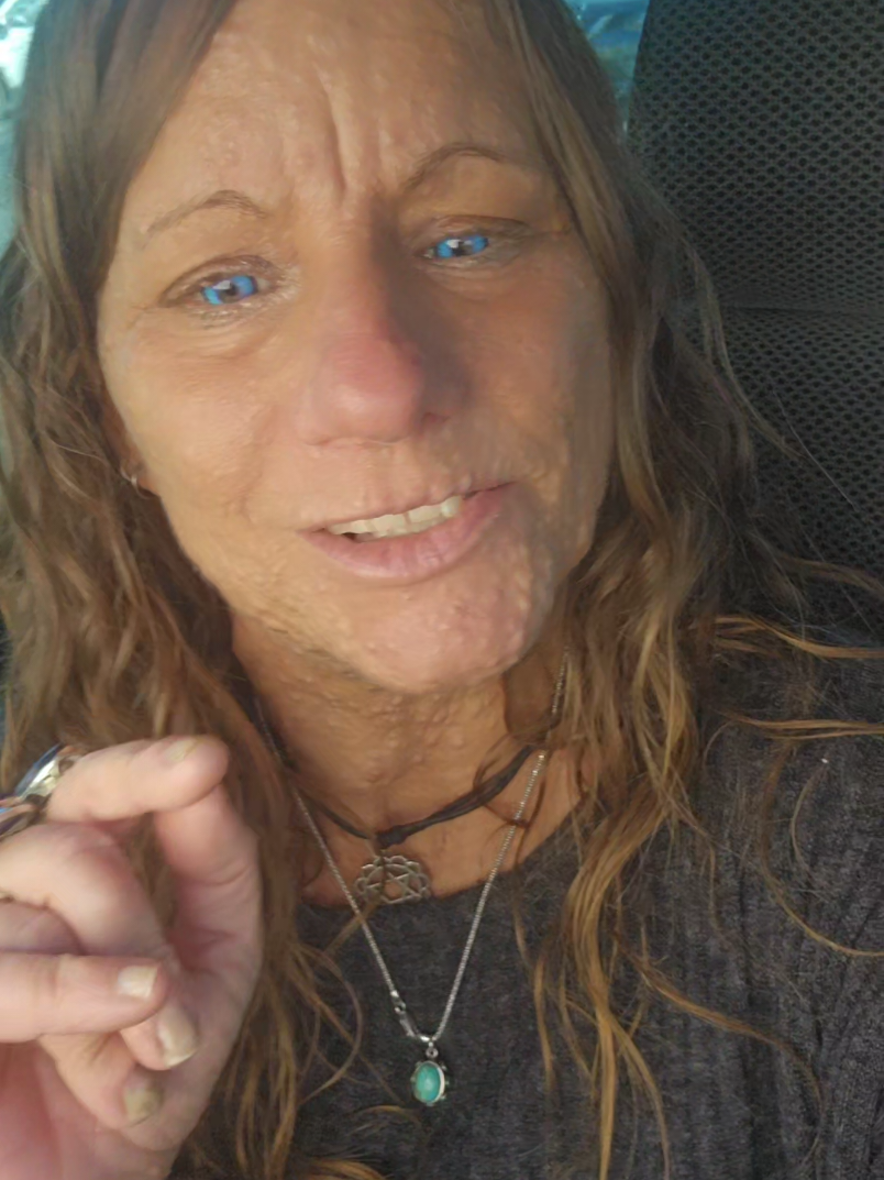 INCREASED AWARENESS for an unpredictable, progressive, genetic neurological disorder that causes tumors to develop anytime & anywhere that there are NERVES present throughout the entire body, known as, NEUROFIBROMATOSIS. It is EXTREMELY IMPORTANT for us to....  ADVOCATE & NF EDUCATE! #nf #Neurofibromatosis #DisorderNotAdisease #libertyeyes #BeTreBeYou  💙💚💙💚💙💚💙💚💙💚💙