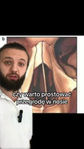 Chcesz poznać ćwiczenia na naturalne odetkanie nosa i wyrobienie nawyku oddychania prawidłowym  torem przeponowym przez nos?  Poprawę wydolności? Jestem certyfikowanym trenerem oddechu dobieram ćwiczenia do potrzeb na podstawie przeprowadzonego wywiadu i testów oddechowych dzięki nim możesz wyrobić nawyk oddychania przez nos, odstawić krople, udrożnić go, zredukować stres lub poprawić wydolnosc po więcej informacji napisz wiadomość prywatna (inzta skuza_sylwek) #oddech #oddychanie #treneroddechu #katar #bieganie 