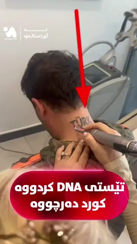 ئەم گەنجە پاش ئەوەی تێستی (Dna) کردووە کورد دەرچووە هەستاوە بە سڕینەوە تاتۆکەی نوسراوە تورک