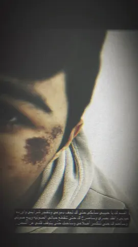 افيدك نفسي يا ابأعبدالله💔. . . . . . . . . . . . . . . . . . . . . . . . . . . . . . . . . . . . . . . . . #حزن #حسيني #اهل_البيت_عليهم_سلام #شور_حتى_الظهور #شور 