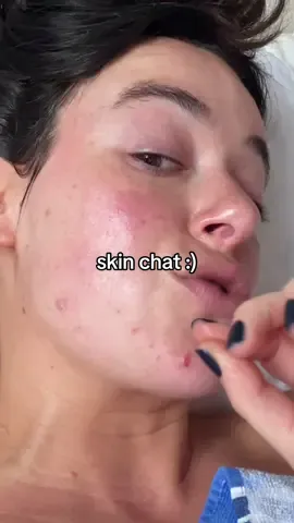 when did we start normalizing filters in beauty content??? Tomato tomato 