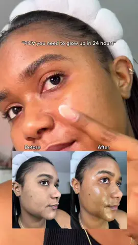 #dryskin  #barriercream  #skinbarrier  #acneprone    #urbanand  @urbanand.official 