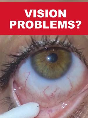 Do THIS Once a Day to Help Restore Vision at Any Age